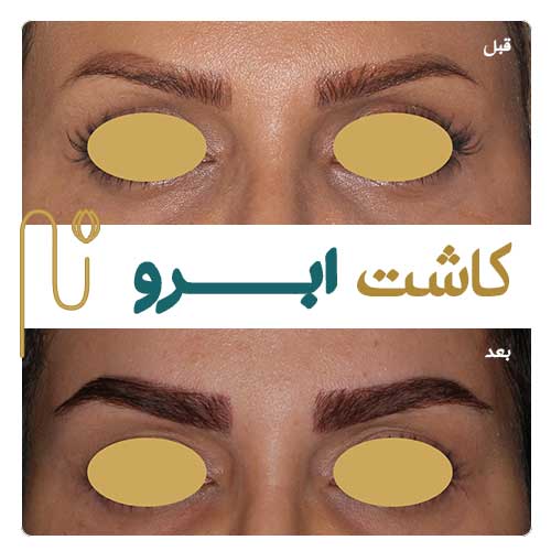 ابروها، قابی برای چشم‌ها