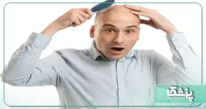 مزایای کاشت موی طبیعی