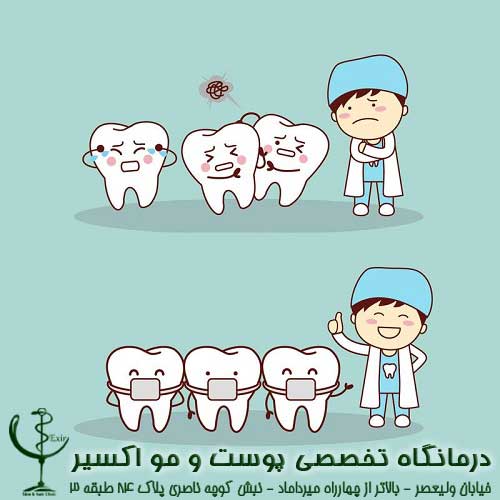 ارتودنسی دندان، انواع و هزینه های آن