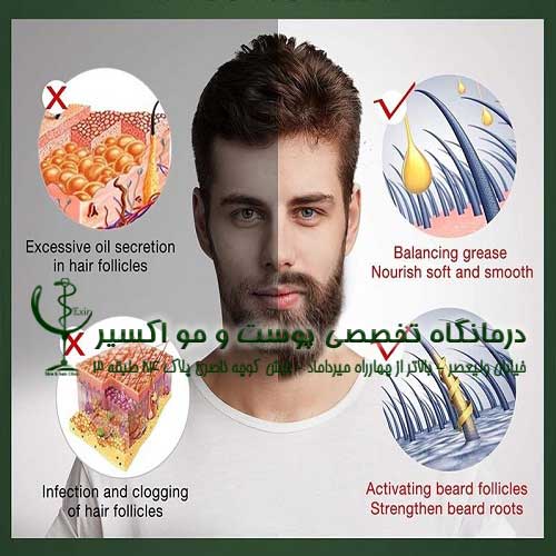 نقش تغذیه و ویتامین ها در تقویت موهای ریش و سبیل