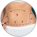 Slimming and Body Jet Liposuction