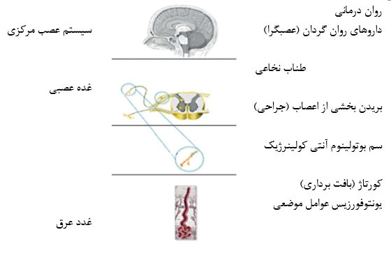 نمودار 1: ناحیه اجرای درمان برای هایپر هیدروزیس اولیه