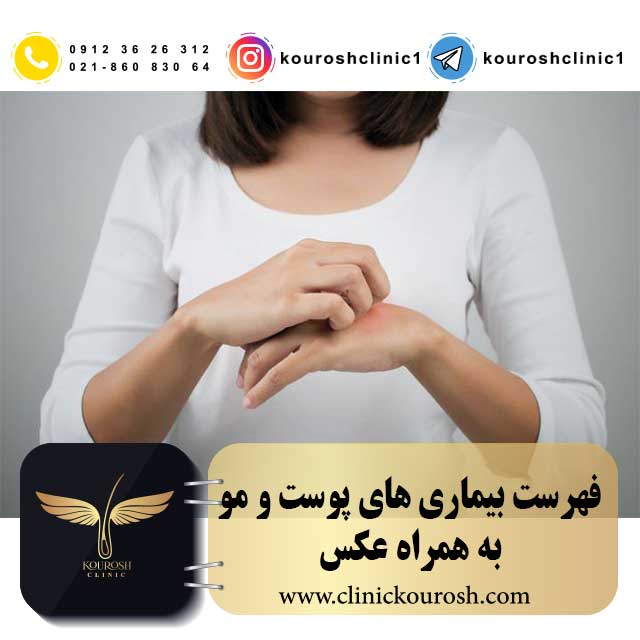 کلینیک پوست و مو کورش