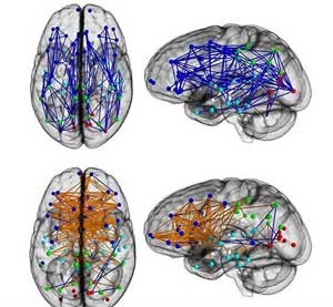 تفاوت جالب و خواندنی مغز مردان و زنان + عکس
